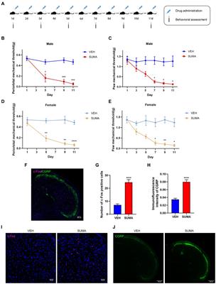 Activation of the microglial P2X7R/NLRP3 inflammasome mediates central sensitization in a mouse model of medication overuse headache